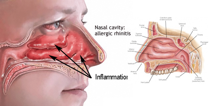 natural treatment for sinus infection in dogs